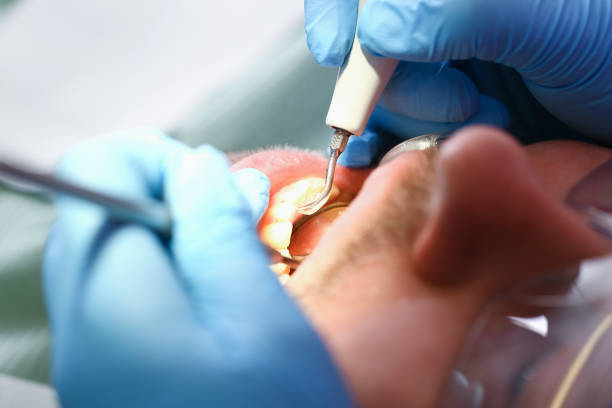 Best Emergency Dental Care for Abscessed Tooth in Beach, ND