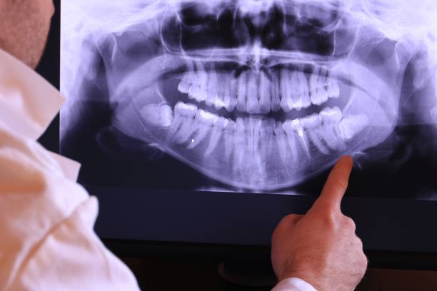 Best Orthodontic Emergency Dentist in Beach, ND