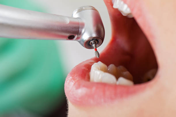 Best Mobile Emergency Dentist in Beach, ND